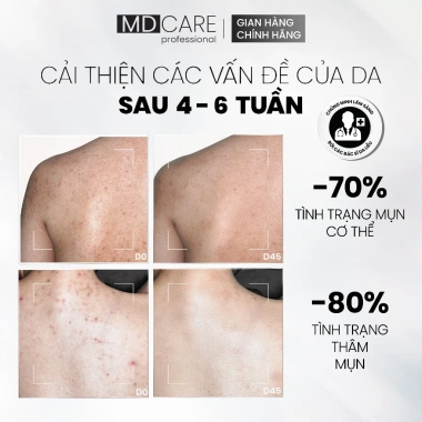Xịt Tẩy Tế Bào Chết Toàn Thân AHAs BHA MD CARE 100ml Da Mịn Mờ Đốm Giá 342k