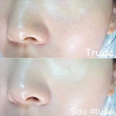 50 gói OHUI Miracle Moisture Ampoule 777 - Dưỡng trắng, da căng bóng, 48.000₫ 4