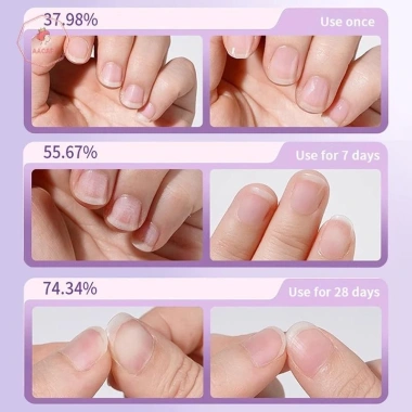 AACAR Dầu Dưỡng Cuticle Anti-barb Pen Nuôi dưỡng, sáng móng tay hư tổn - 46.200₫ 8 AACAR Dầu Dưỡng Cuticle Anti-barb Pen Nuôi dưỡng, sáng móng tay hư tổn - 46.200₫ 8