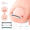 AACAR Dụng Cụ Làm Móng Chân Mọc Ngược - Kẹp Chỉnh Sửa Móng Tay, Kẹp Cong, Giá Ưu Đãi 46.934 VND