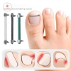 AACAR Dụng Cụ Làm Móng Chân Mọc Ngược - Kẹp Chỉnh Sửa Móng Tay, Kẹp Cong, Giá Ưu Đãi 46.934 VND 3