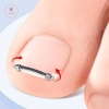AACAR Dụng Cụ Làm Móng Chân Mọc Ngược - Kẹp Chỉnh Sửa Móng Tay, Kẹp Cong, Giá Ưu Đãi 46.934 VND 6