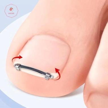AACAR Dụng Cụ Làm Móng Chân Mọc Ngược - Kẹp Chỉnh Sửa Móng Tay, Kẹp Cong, Giá Ưu Đãi 46.934 VND