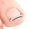 AACAR Dụng Cụ Làm Móng Chân Mọc Ngược - Kẹp Chỉnh Sửa Móng Tay, Kẹp Cong, Giá Ưu Đãi 46.934 VND 7