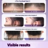 AACAR Keo Sáp Tóc Giả Bay Frizz, Cố Định Lông Tơ, Cho Trẻ Em Nam Nữ, Giảm Giá 9