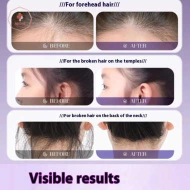 AACAR Keo Sáp Tóc Giả Bay Frizz, Cố Định Lông Tơ, Cho Trẻ Em Nam Nữ, Giảm Giá