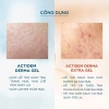 Actidem Derma Gel 18gr - Gel giảm mụn nhanh, trị hiệu quả, giá chỉ 105.000đ 4