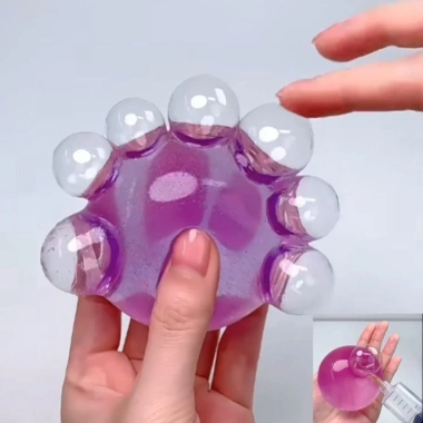 ADAMESUO TPR Ball - Đồ chơi nhồi bông mô phỏng mụn trứng cá, bong bóng trong suốt chắc chắn, ngộ nghĩnh