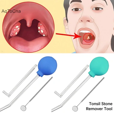Aqtocna Bộ 3 Cái Dụng Cụ Tẩy Đá Tonsil – Vệ Sinh Miệng, Loại Bỏ Tonsil, Dụng Cụ Không Khí HGVN – Giá 176.660₫