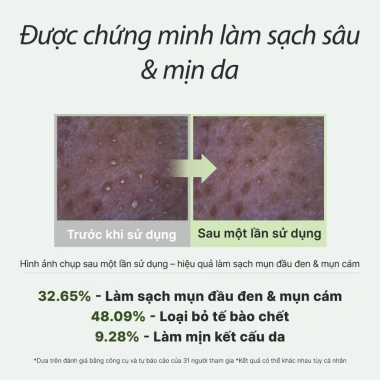 Arencia Sữa rửa mặt Mochi Gạo Xanh Tươi 120g - Làm sạch, Cấp ẩm, Xóa mụn đầu đen, Giá ưu đãi 373k 6 Arencia Sữa rửa mặt Mochi Gạo Xanh Tươi 120g - Làm sạch, Cấp ẩm, Xóa mụn đầu đen, Giá ưu đãi 373k 6