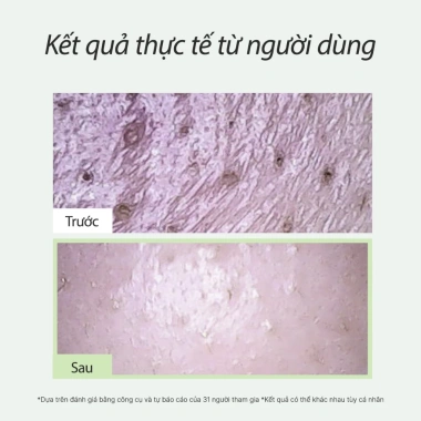 Arencia Sữa rửa mặt Mochi Gạo Xanh Tươi 120g - Làm sạch, Cấp ẩm, Xóa mụn đầu đen, Giá ưu đãi 373k 7 Arencia Sữa rửa mặt Mochi Gạo Xanh Tươi 120g - Làm sạch, Cấp ẩm, Xóa mụn đầu đen, Giá ưu đãi 373k 7