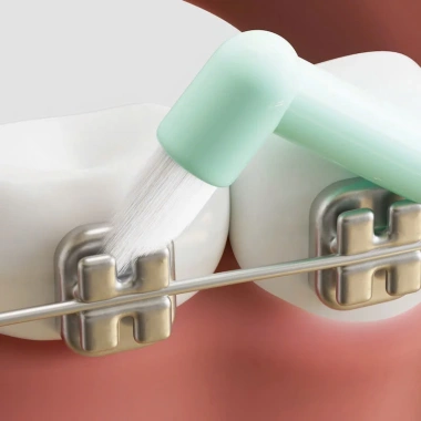 Bàn chải kẽ răng cho răng niềng đầu nhọn, đầu phẳng, tay cầm nhỏ gọn, giá 23.000đ 7 Bàn chải kẽ răng cho răng niềng đầu nhọn, đầu phẳng, tay cầm nhỏ gọn, giá 23.000đ 7