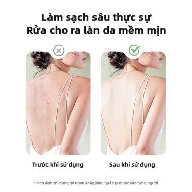 Bàn Chải Tắm Điện EXYT Spa 5 in 1 Xoay 360 IPX6 5 Đầu Chải USB - Vệ Sinh Toàn Thân 7 Bàn Chải Tắm Điện EXYT Spa 5 in 1 Xoay 360 IPX6 5 Đầu Chải USB - Vệ Sinh Toàn Thân 7