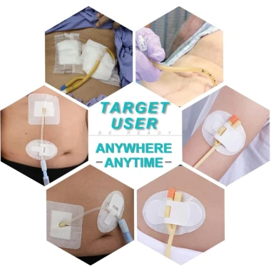 Băng Đô Cố Định Miếng Dán PD Ống Thông Dùng Một Lần, Giá Đỡ PICC & Tiết Niệu, Gói Riêng – 15.312₫