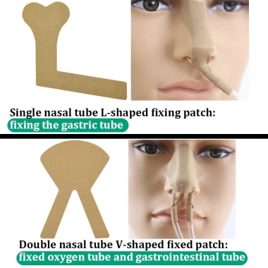 Băng Đô Cố Định Miếng Dán PD Ống Thông Dùng Một Lần, Giá Đỡ PICC & Tiết Niệu, Gói Riêng – 15.312₫ 8 Băng Đô Cố Định Miếng Dán PD Ống Thông Dùng Một Lần, Giá Đỡ PICC & Tiết Niệu, Gói Riêng – 15.312₫ 8