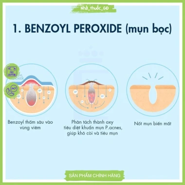 Benzoyl Peroxide EZOYB 5-10% - Kem giảm mụn trứng cá, trị mụn bọc, chỉ 42.153 VND