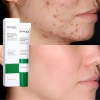 BIOAOUA Kem Saucylic Acid loại bỏ mụn nhẹ nhàng, phai màu, cải thiện da, chống mụn dầu - Giá 60.500 VND 2