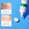 BIOAOUA Kem Saucylic Acid loại bỏ mụn nhẹ nhàng, phai màu, cải thiện da, chống mụn dầu - Giá 60.500 VND 4