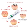BIOAOUA Kem Saucylic Acid loại bỏ mụn nhẹ nhàng, phai màu, cải thiện da, chống mụn dầu - Giá 60.500 VND 5