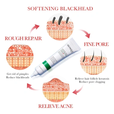BIOAOUA Kem Saucylic Acid loại bỏ mụn nhẹ nhàng, phai màu, cải thiện da, chống mụn dầu - Giá 60.500 VND