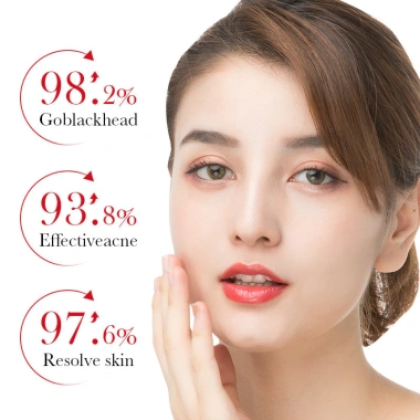 BIOAOUA Kem Saucylic Acid loại bỏ mụn nhẹ nhàng, phai màu, cải thiện da, chống mụn dầu - Giá 60.500 VND