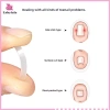 Bộ 10 chiếc Dụng cụ làm thẳng móng chân mọc ngược - Mới, Giá ưu đãi 37.180₫, an toàn, dễ dùng, đẹp, nhanh chóng 2