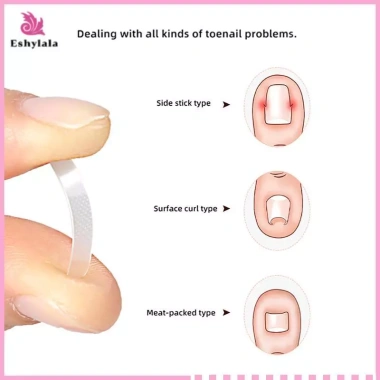 Bộ 10 chiếc Dụng cụ làm thẳng móng chân mọc ngược - Mới, Giá ưu đãi 37.180₫, an toàn, dễ dùng, đẹp, nhanh chóng