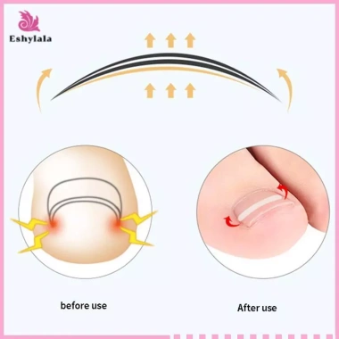 Bộ 10 chiếc Dụng cụ làm thẳng móng chân mọc ngược - Mới, Giá ưu đãi 37.180₫, an toàn, dễ dùng, đẹp, nhanh chóng