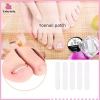 Bộ 10 chiếc Dụng cụ làm thẳng móng chân mọc ngược - Mới, Giá ưu đãi 37.180₫, an toàn, dễ dùng, đẹp, nhanh chóng 7
