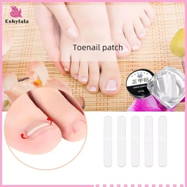 Bộ 10 chiếc Dụng cụ làm thẳng móng chân mọc ngược - Mới, Giá ưu đãi 37.180₫, an toàn, dễ dùng, đẹp, nhanh chóng 7 Bộ 10 chiếc Dụng cụ làm thẳng móng chân mọc ngược - Mới, Giá ưu đãi 37.180₫, an toàn, dễ dùng, đẹp, nhanh chóng 7