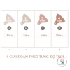 Bộ 2 núm ti Moyuum cổ rộng số 3 (6-8 tháng) Thế hệ 3 Giá ưu đãi 187k 4