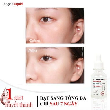 Bộ 3 Dưỡng Trắng Da Angel's Glutathione 700 - Niacinamide + Kem Đêm, Thâm Nám, 1,377,000 VND 6