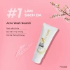 Bộ 3 Neutidi chăm sóc da dầu mụn - Làm sạch kiềm dầu, giảm thâm, sáng da, 425k 6