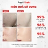 Bộ 3 Nước Thần Glutathione Arbutin Serum Kem Dưỡng Trắng Da, Khít Lỗ Chân Lông 1.599.000₫ 5