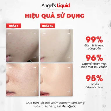 Bộ 3 Nước Thần Glutathione Arbutin Serum Kem Dưỡng Trắng Da, Khít Lỗ Chân Lông 1.599.000₫