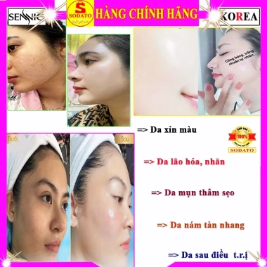 Bộ 4 sản phẩm Sennio Hàn Quốc chính hãng - Kem dưỡng da bộ hộp xanh, giảm giá 5