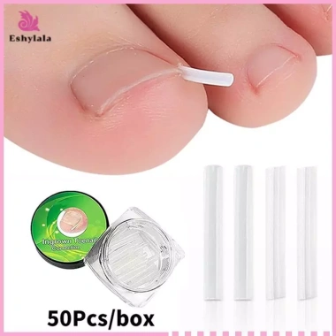 Bộ 50 dụng cụ chỉnh sửa móng chân mọc ngược - miếng dán đàn hồi, thẳng, kẹp nẹp, giá chỉ 35.900 VND