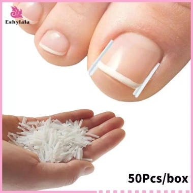 Bộ 50 dụng cụ chỉnh sửa móng chân mọc ngược - miếng dán đàn hồi, thẳng, kẹp nẹp, giá chỉ 35.900 VND 3 Bộ 50 dụng cụ chỉnh sửa móng chân mọc ngược - miếng dán đàn hồi, thẳng, kẹp nẹp, giá chỉ 35.900 VND 3
