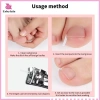 Bộ 50 dụng cụ chỉnh sửa móng chân mọc ngược - miếng dán đàn hồi, thẳng, kẹp nẹp, giá chỉ 35.900 VND 8