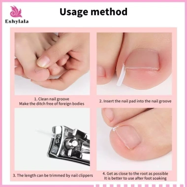 Bộ 50 dụng cụ chỉnh sửa móng chân mọc ngược - miếng dán đàn hồi, thẳng, kẹp nẹp, giá chỉ 35.900 VND 8 Bộ 50 dụng cụ chỉnh sửa móng chân mọc ngược - miếng dán đàn hồi, thẳng, kẹp nẹp, giá chỉ 35.900 VND 8