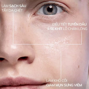 Bộ chăm sóc da dầu mụn AHA BHA PHA Compliment: sữa rửa mặt, serum, kem dưỡng ẩm, kem chấm mụn