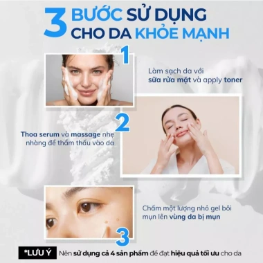 Bộ chăm sóc da dầu mụn AHA BHA PHA Compliment: sữa rửa mặt, serum, kem dưỡng ẩm, kem chấm mụn