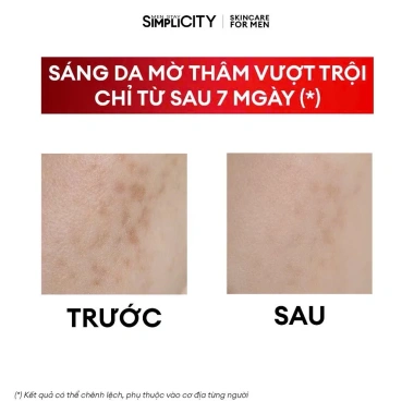 Bộ chăm sóc da nam Men Stay Brightening Trio - Sáng da, mờ thâm, giá 555.000 6