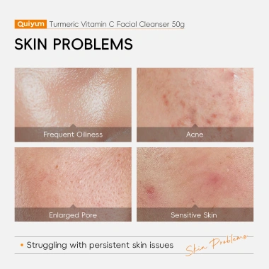 Bộ chăm sóc da nghệ & Vitamin C QUIYUM 4 món - Sữa rửa mặt, Serum, Kem mắt, Kem mặt, giảm nếp nhăn, sáng da - 121k