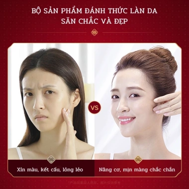 Bộ chăm sóc da nhân sâm Hàn Quốc chính hãng – làm trắng, dưỡng ẩm, chống nhăn, nuôi da chỉ 750.000