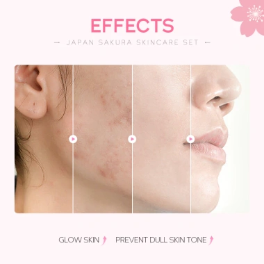 Bộ chăm sóc da Sakura Nhật Bản 5+4 – Làm trắng, giảm nếp nhăn, Fade Spots