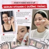 Bộ Combo Dưỡng Da Sắc Ngọc Khang – Serum Vitamin C Trắng Da + Kem Ban Ngày Đêm Giá 1.063.000 8