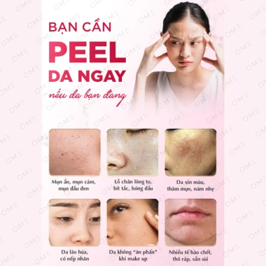 Bộ Combo Peel Da Dưỡng Trắng Cấp Ẩm Phục Hồi và Tái Tạo Da MAKE9 - Giá ưu đãi 648k, không bong tróc 2