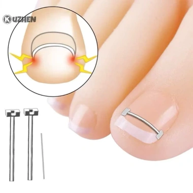 Bộ dụng cụ niềng móng chân 10pcs - Sửa lỗi móng chân mọc ngược, chỉ 100.000đ