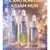 Bộ Dưỡng Trắng Căng Bóng Da AHA BEU Serum và Kem Dưỡng Da Sáng Mịn Giảm Đốm Nâu Giá Ưu Đãi 1.395.000₫ 2